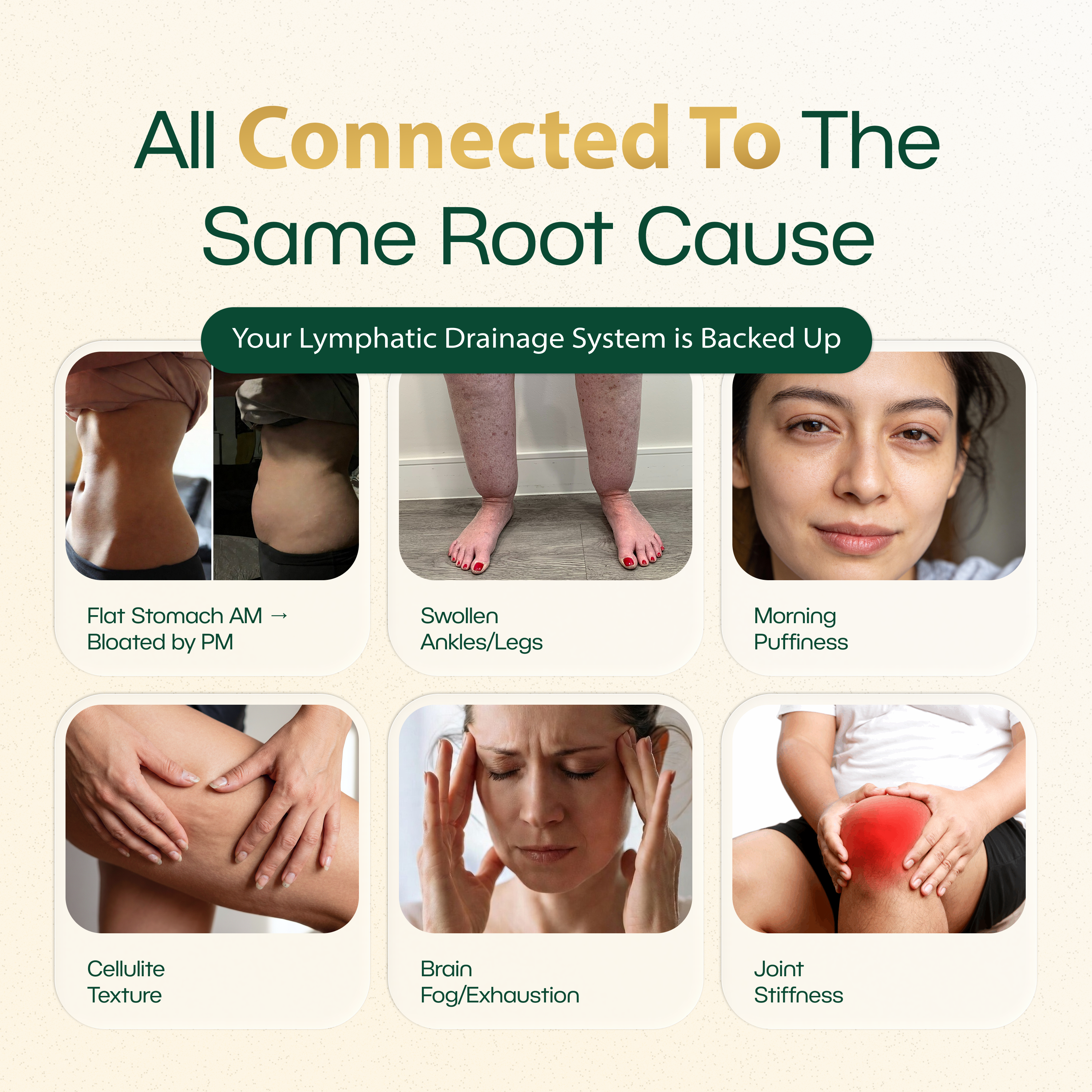 New Maximum Potency Formula - Lymphatic Drainage Capsules by Lymphelle™