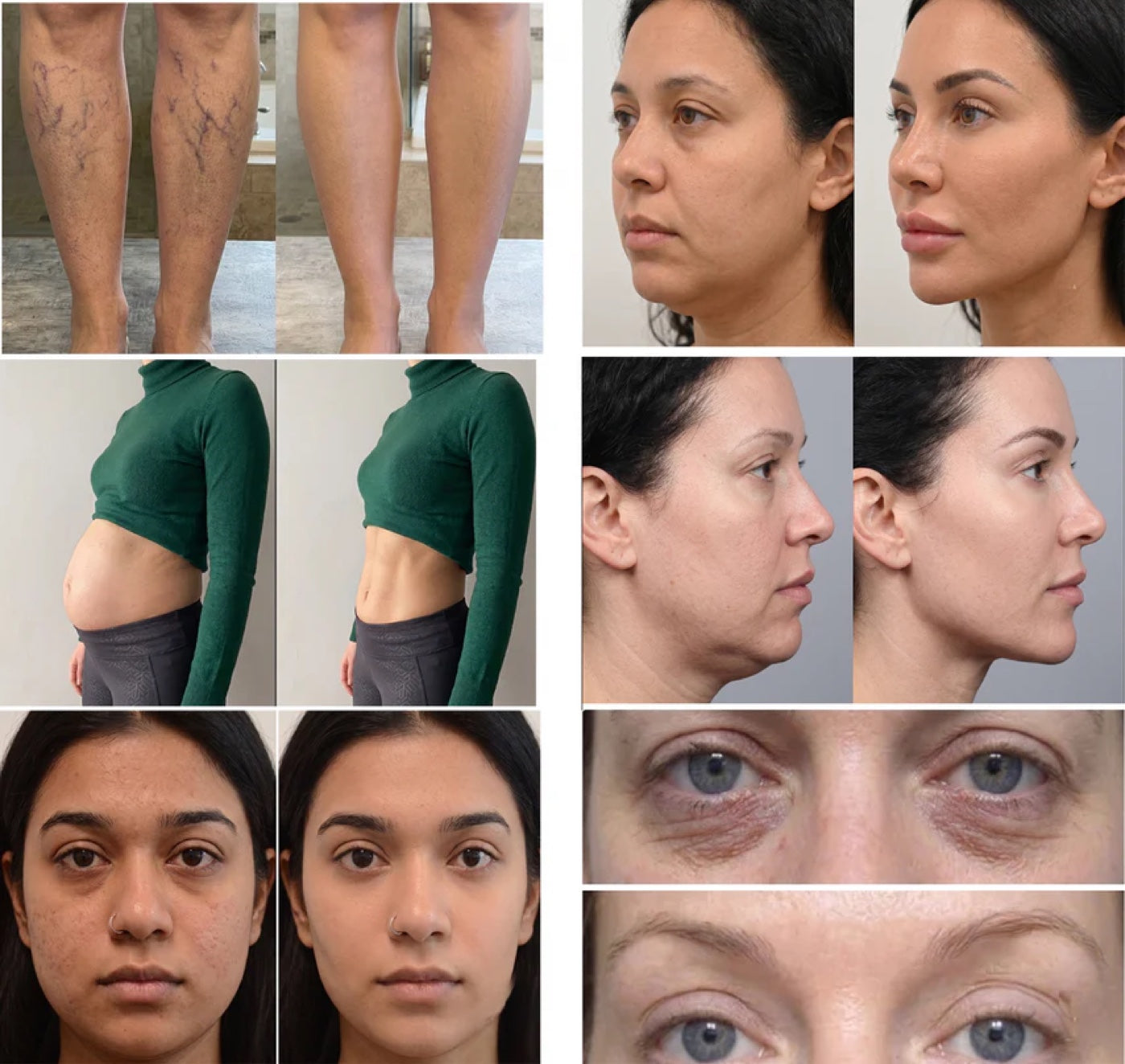 Before and after results: reduced leg vein visibility, flatter stomach, clearer skin, defined jawline and reduced under-eye puffiness